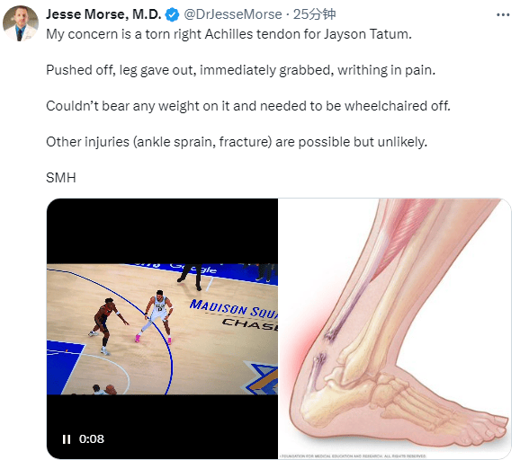 九游APP-巴黎在比赛中受伤退赛，塔图姆主帅表示担忧